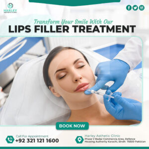 41272c219107621.67ac82f4cded6