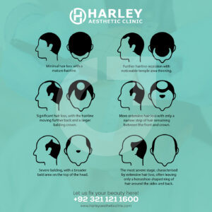 b634ef219107621.67ac82f4dc651