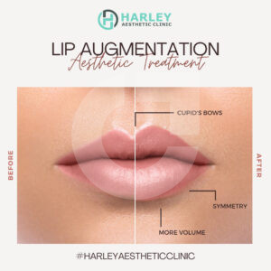 c2e4de219107621.67ac82f4d36d2