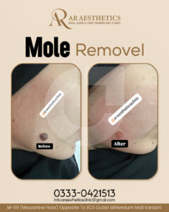 c40c95221301431.67d1f539f3ad2