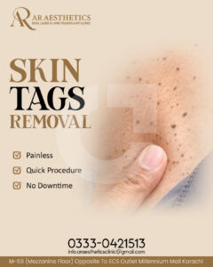 d28753221301431.67d1f53a01a70