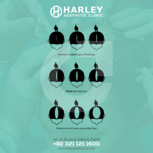 fe6e28219107621.67ac82f4d9f3c